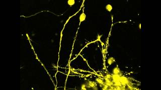 Dynamic monitoring of neuronal mitochondrial organization [upl. by Ck79]