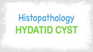 Hydatid Cyst histopathology features [upl. by Nnaarat]