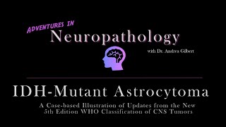 IDH  Mutant Astrocytoma Update from the 5th Edition WHO Classification of CNS Tumors [upl. by Hermine501]