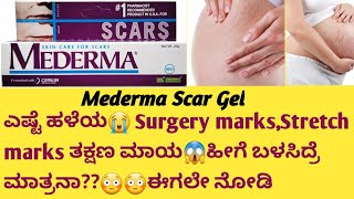 Mederma Scar Gel Review in kannadaUsesside effectssafety Advice surgeryrecovery stretchmarks [upl. by Selrahcnhoj]