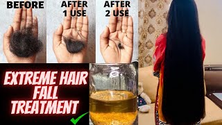 Hair fall treatment at home  💯 results home remedy ​⁠Zonnilifestyle [upl. by Max]