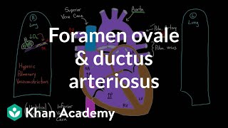 Foramen ovale and ductus arteriosus  Circulatory system physiology  NCLEXRN  Khan Academy [upl. by Aluap]