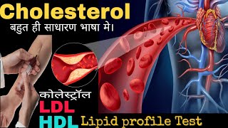 Cholesterol lipid profile testLDLHDL in Hindiby DOCTORLab [upl. by Merrili702]