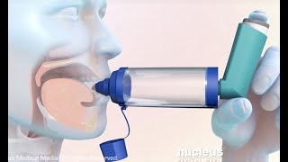 How to Use a Metered Dose Inhaler with a Spacer [upl. by Fauver184]