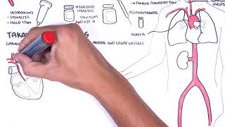 Giant cell Arteritis and Takayasu arteritis Large Vessel Vasculitis  signs pathophysiology [upl. by Faria]