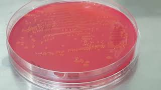 Colony characteristics of Escherichia coli on CLED Agar of Urine Culture [upl. by Adyeren]