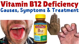 Vitamin B12 Deficiency – Symptoms Causes Diagnosis Treatment amp Prevention  Cobalamin Deficiency [upl. by Wooster]