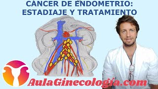 TRATAMIENTO y ESTADIAJE del CÁNCER de ENDOMETRIO cirugía quimio y radio  Ginecología y Obstetricia [upl. by Elleinet]