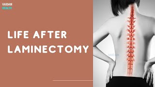 Life After Laminectomy [upl. by Arly]