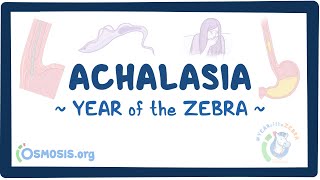 Achalasia Year of the Zebra [upl. by Mizuki]