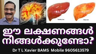 കരൾ രോഗങ്ങൾ  Dr Xavier Reveals Ayurvedic SECRETS for Liver Health [upl. by Niahs]