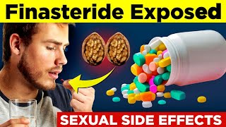 5 Finasteride SIDE EFFECTS Exposed that will SHOCK YOU 🤯  Finasteride Results [upl. by Maretz]