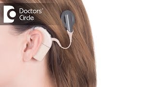 What is Cochlear Implant Surgery  Dr Sheelu Srinivas [upl. by Atinniuq]