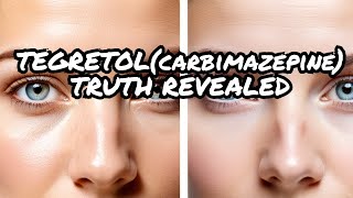 The Shocking truth about Tegretolcarbamazepine [upl. by Jermayne]