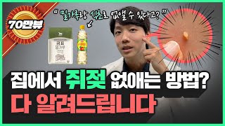 밀가루 식초로 쥐젖을 제거할 수 있다고 슈퍼동안 40대 의사가 알려주는 쥐젖없애는 방법 [upl. by Nonie471]