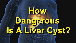 How Dangerous Is A Liver Cyst [upl. by Hannaj]