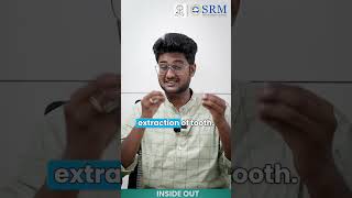 Dry Socket Dilemma  SRM Kattankulathur Dental College amp Hospital  SRMIST [upl. by Nohsed]