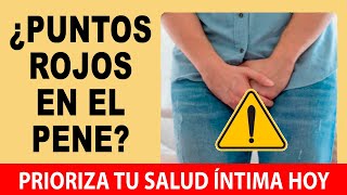 Puntos Rojos En El Glande 💥 Soluciones Efectivas Guía Práctica Sobre La Balanitis [upl. by Nimrak]