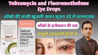 Tobramycin and Fluorometholone ophthalmic suspension uses  Fmlt eye drop  Toba f eye drop [upl. by Konstance]