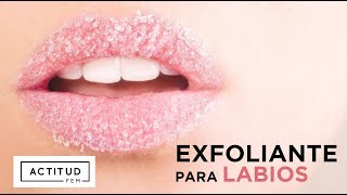 ¿Labios resecos ¡Aquí está la solución rápida y muy barata  ActitudFEM [upl. by Zahc843]