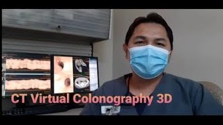 Virtual colonoscopy VC also called CT colonography or CT pneumocolon [upl. by Anallise]