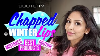 Doctor V  Chapped Winter Lip Care  Skin Of Colour  Brown Or Black Skin [upl. by Steven]