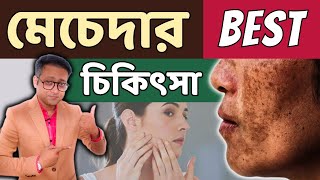 Melasma  Cause amp Treatment  মেচেদা সারানোর উপায়  Dr Supratim Saha [upl. by Irahcaz]