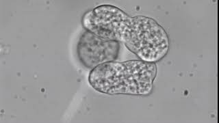 Entamoeba histolytica trophozoites [upl. by Lonny]