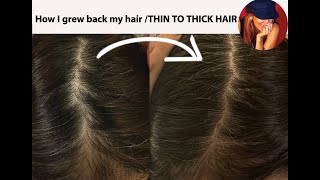 STOP Losing Hair and START Growing with My 8 Week Method honest review about PHYTO [upl. by Nawat]