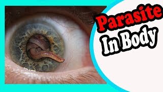 10 Signs And Symptoms Your Body is Full of Parasites [upl. by Itraa]