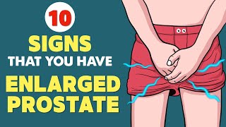 Enlarged Prostate BPH  Signs amp Symptoms  Every Man Needs to Know This [upl. by Lorenz155]