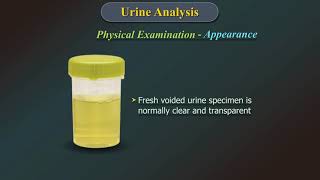 Urine Analysis [upl. by Eemyaj]