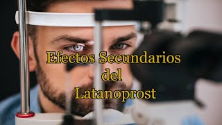 Efectos Secundarios del Latanoprost [upl. by Muldon]