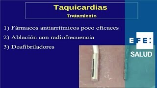 Tratamiento de las arritmias de taquicardia fármacos ablación y desfibrilador [upl. by Aynat]