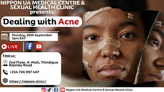 DEALING WITH ACNE [upl. by Borchers]