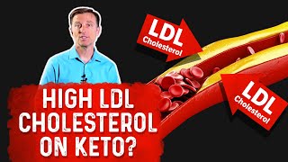 Why High LDL Cholesterol on the Ketogenic Diet – Dr Berg [upl. by Kilam944]