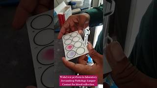 Widal test perform in laboratory by Slide method CBC widal malaria tests shorts viral cbc tests [upl. by Holladay]