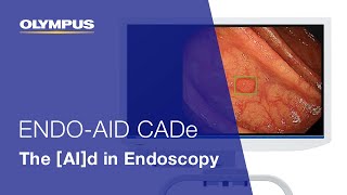 ENDOAID CADe The AId in Endoscopy  EVIS X1  Gastroenterology  OLYMPUS [upl. by Tisbee]