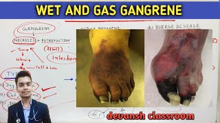 general Pathology  wet and gas gangrene  Hindi [upl. by Yecrad468]