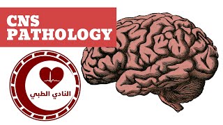 CNS Pathology  Edema Hydrocephalus amp Herniation [upl. by Mendie829]