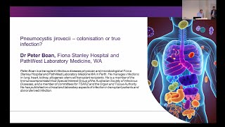 Pneumocystis jirovecii – colonisation or true infection Dr Peter Boan [upl. by Baptlsta]