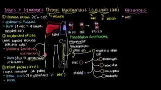 What is chronic myelogenous leukemia [upl. by Sikras]