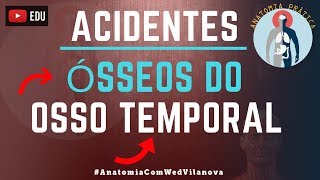 Osso Temporal ACIDENTES ÓSSEOS Quais são❗❓DESCUBRA AQUI❗ Anatomia Prática [upl. by Nimad]