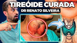 COMO RECUPERAR A TIREÓIDE E EMAGRECER RÁPIDO  DR RENATO SILVEIRA [upl. by Nnire]