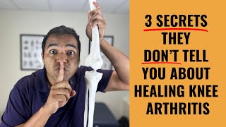 Top 3 Secret Ways To Slow Down And Even Stop Knee Arthritis Progression [upl. by Sherlock]