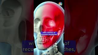 Understanding Migraines Insights from Dr K Ravishankar  Medicine Box  N18S  CNBC TV18 [upl. by Levina]