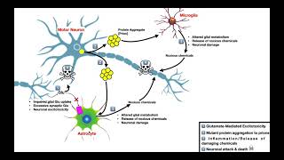 Amyotrophic Lateral Sclerosis ALS  Mechanism of Neuron Death [upl. by Winchell516]