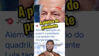 O LULA FEZ🔥PLÁSTICA DE PÁLPEBRAS BLEFAROPLASTIA cirurgiaplastica cirurgiadepalpebras presidente [upl. by Sadnac929]