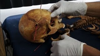 Extended Version From Guatemalan Soil Unearthing Evidence of Genocide [upl. by Hands]