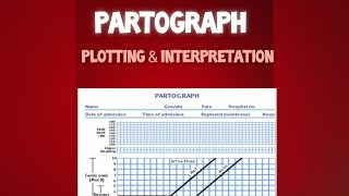 Plotting and Interpretation of Partograph [upl. by Okuy]